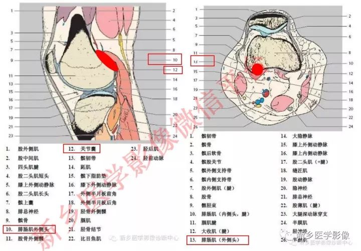 膝关节的15个滑囊解剖