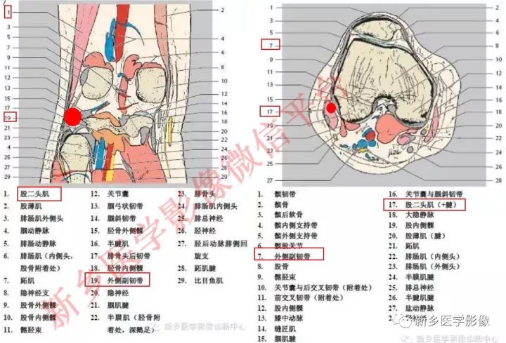 膝关节的15个滑囊解剖