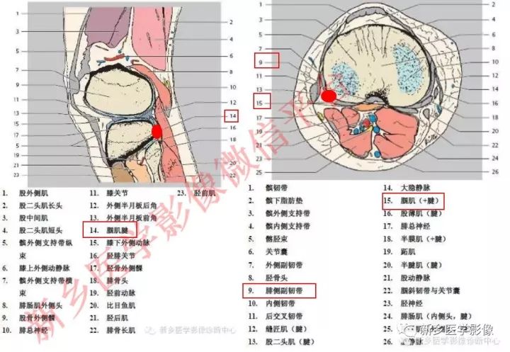 膝关节的15个滑囊解剖