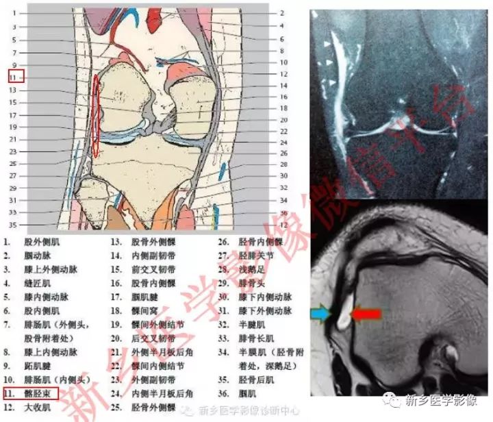 膝关节的15个滑囊解剖