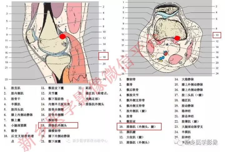 膝关节的15个滑囊解剖