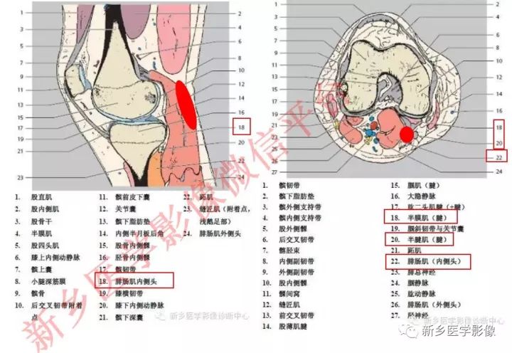 膝关节的15个滑囊解剖