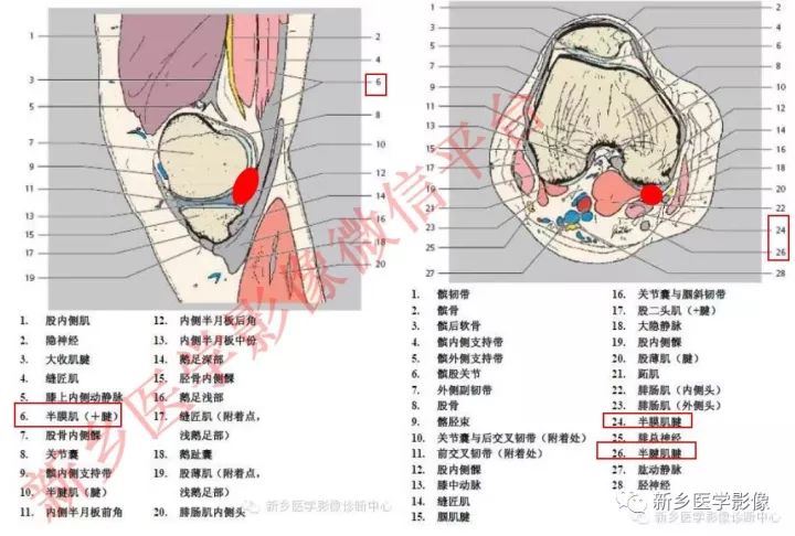 膝关节的15个滑囊解剖