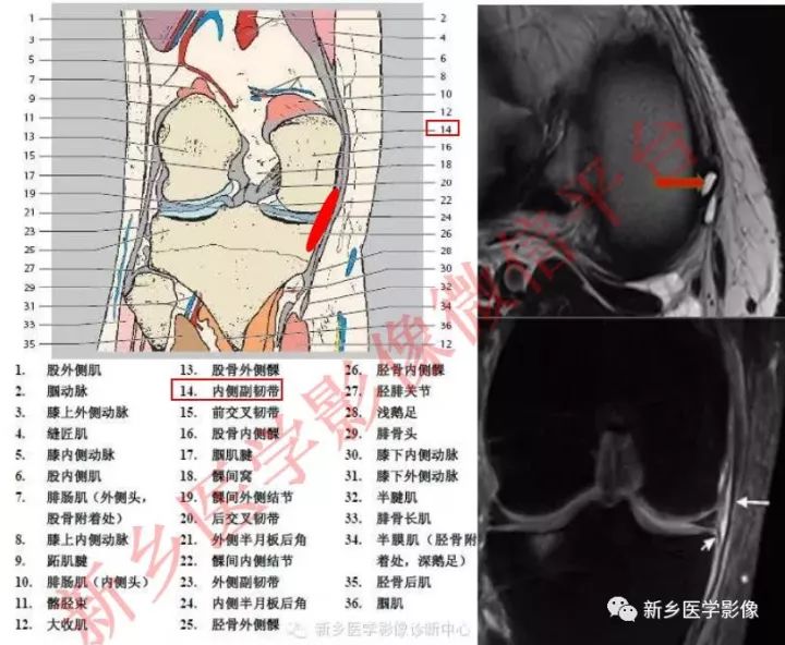 膝关节的15个滑囊解剖