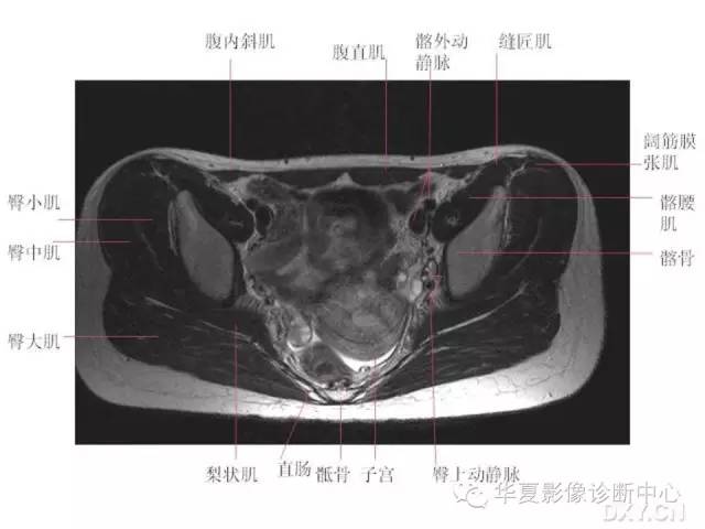 髋关节MRI解剖（高清）