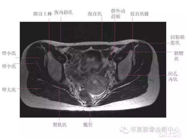 髋关节MRI解剖（高清）