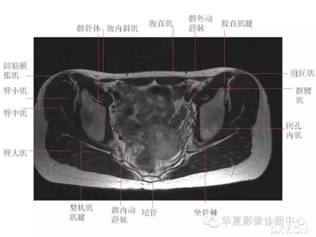 髋关节MRI解剖（高清）