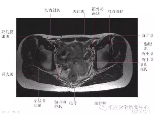 髋关节MRI解剖（高清）
