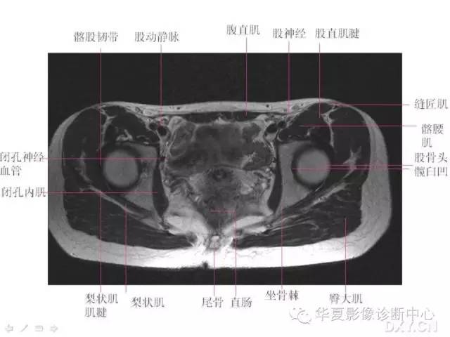 髋关节MRI解剖（高清）