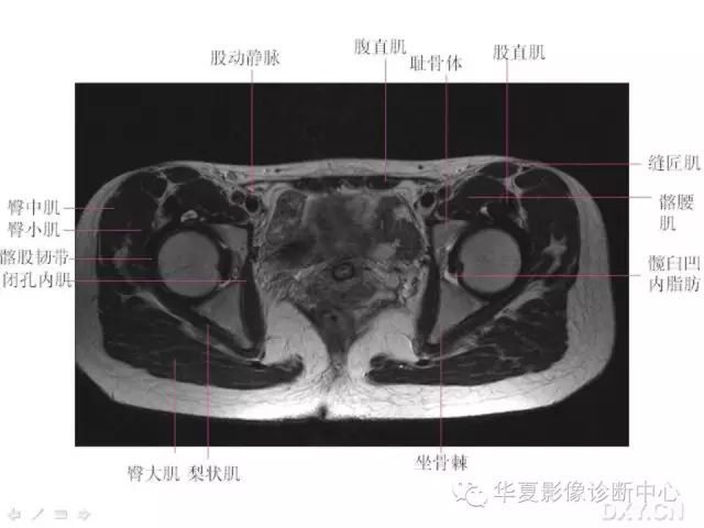 髋关节MRI解剖（高清）