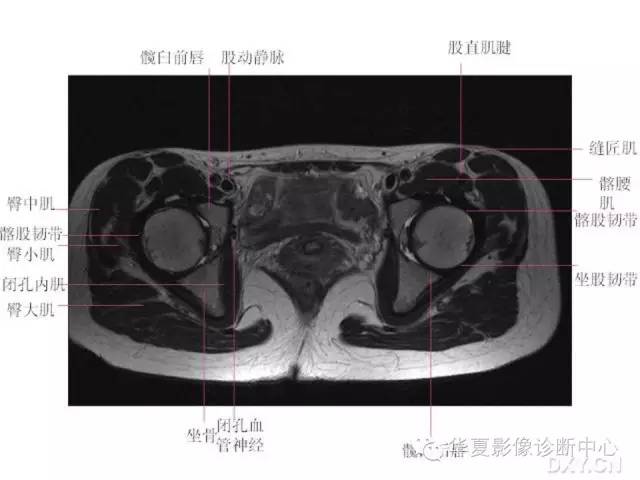 髋关节MRI解剖（高清）