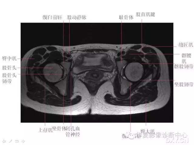 髋关节MRI解剖（高清）