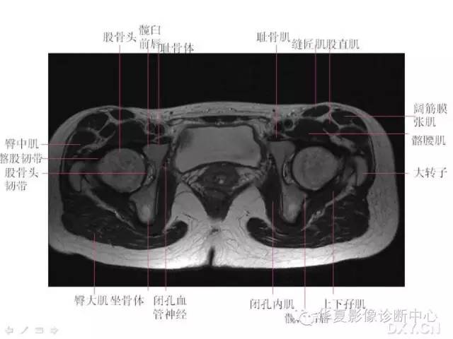 髋关节MRI解剖（高清）