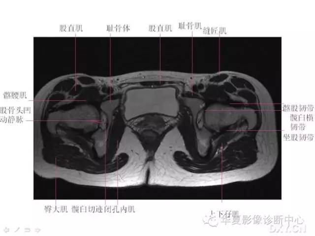 髋关节MRI解剖（高清）