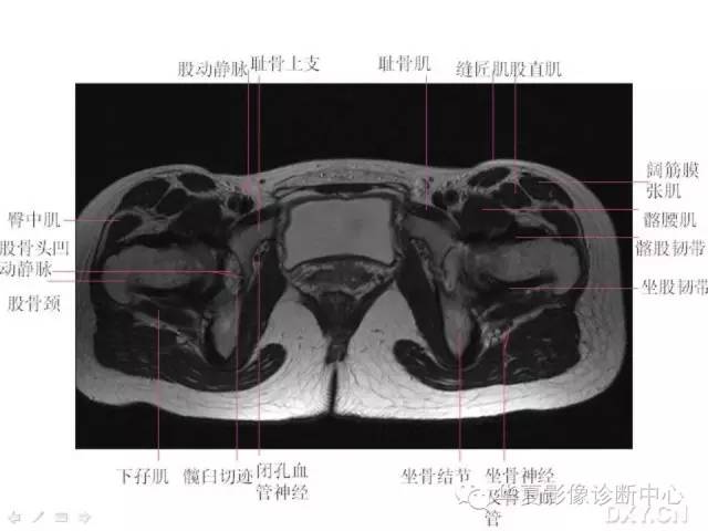 髋关节MRI解剖（高清）