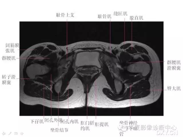 髋关节MRI解剖（高清）