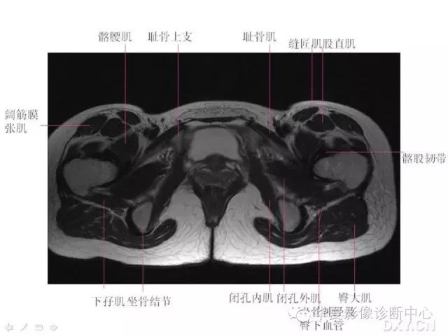 髋关节MRI解剖（高清）