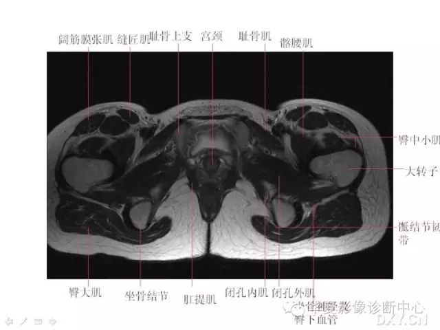 髋关节MRI解剖（高清）