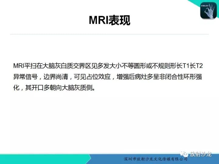 【病例】肿瘤样炎性脱髓鞘病1例MR影像表现