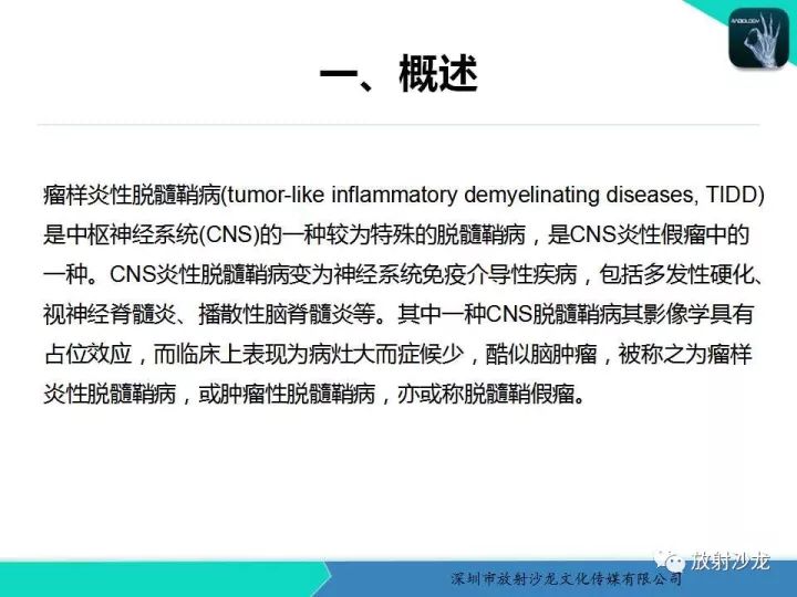 【病例】肿瘤样炎性脱髓鞘病1例MR影像表现