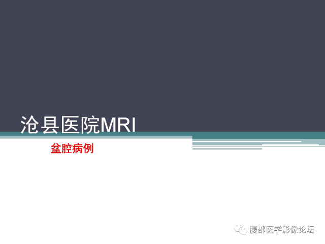 【病例】卵巢甲状腺肿1例MR