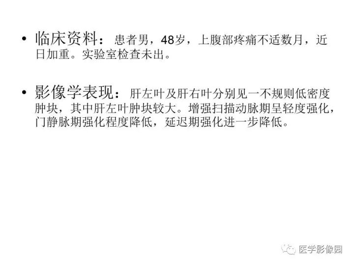 【病例】原发性肝癌1例CT影像表现