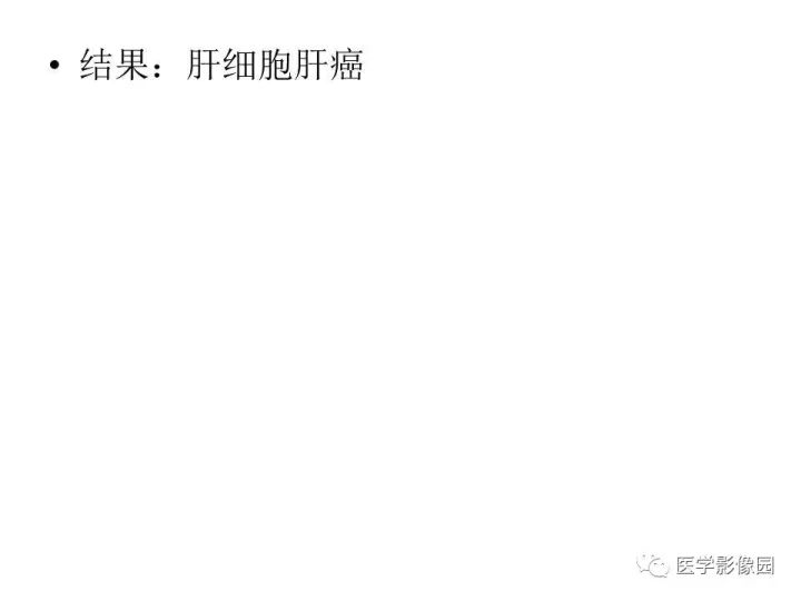 【病例】原发性肝癌1例CT影像表现