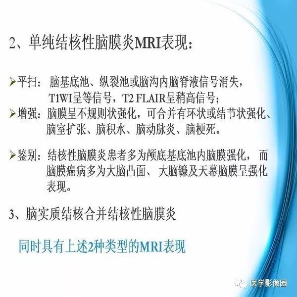 【PPT】颅内结核MRI影像表现及鉴别诊断