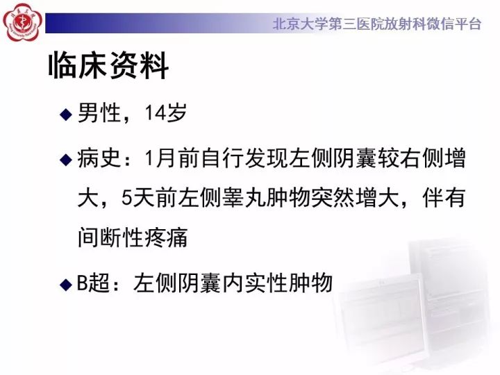 【病例】睾丸横纹肌肉瘤1例CT及MR影像思路分析