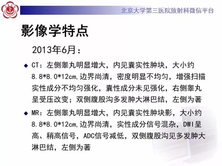 【病例】睾丸横纹肌肉瘤1例CT及MR影像思路分析