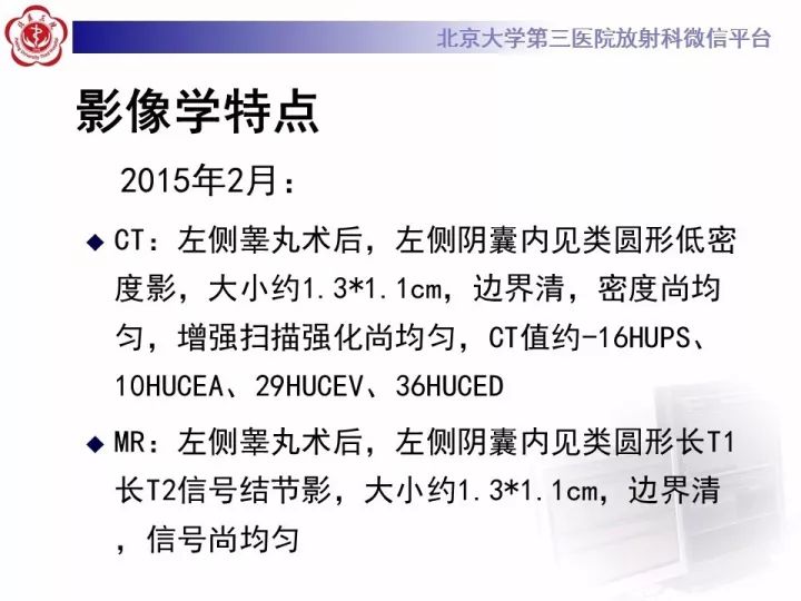 【病例】睾丸横纹肌肉瘤1例CT及MR影像思路分析