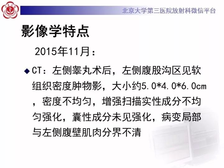 【病例】睾丸横纹肌肉瘤1例CT及MR影像思路分析