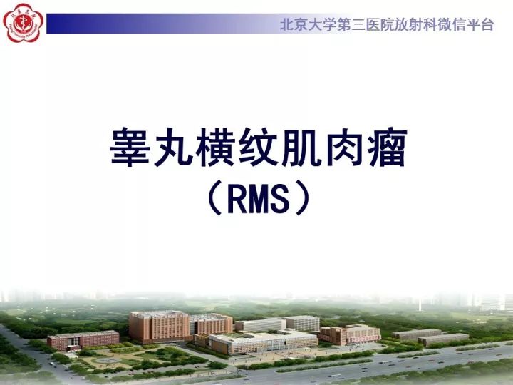 【病例】睾丸横纹肌肉瘤1例CT及MR影像思路分析