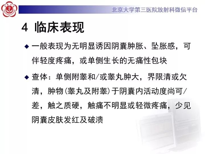 【病例】睾丸横纹肌肉瘤1例CT及MR影像思路分析
