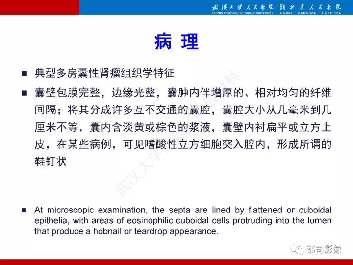 【PPT】多房囊性肾瘤影像诊断