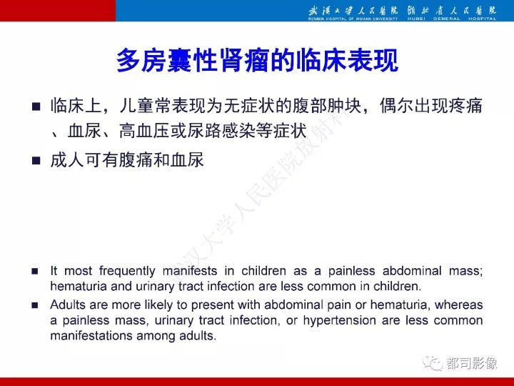 【PPT】多房囊性肾瘤影像诊断