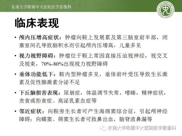 【病例】颅咽管瘤1例MR影像表现