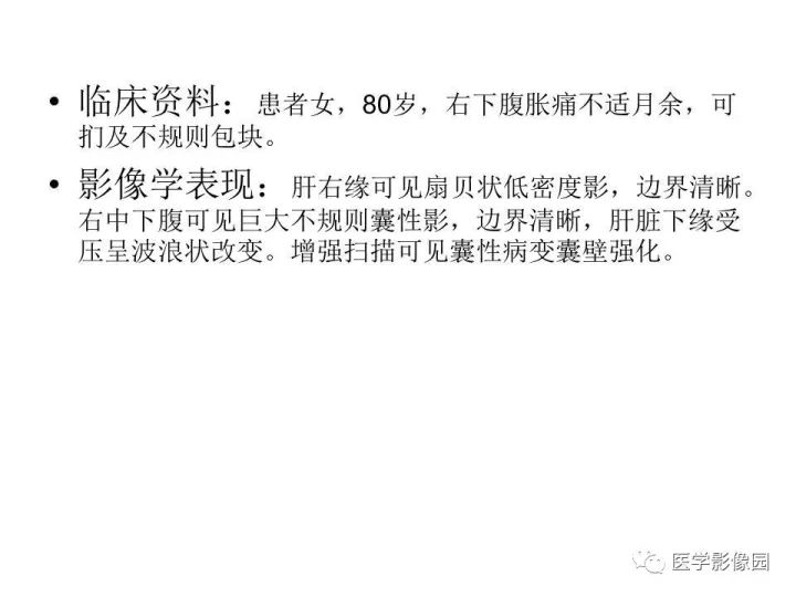 【病例】腹腔多发假性粘液瘤1例CT影像表现