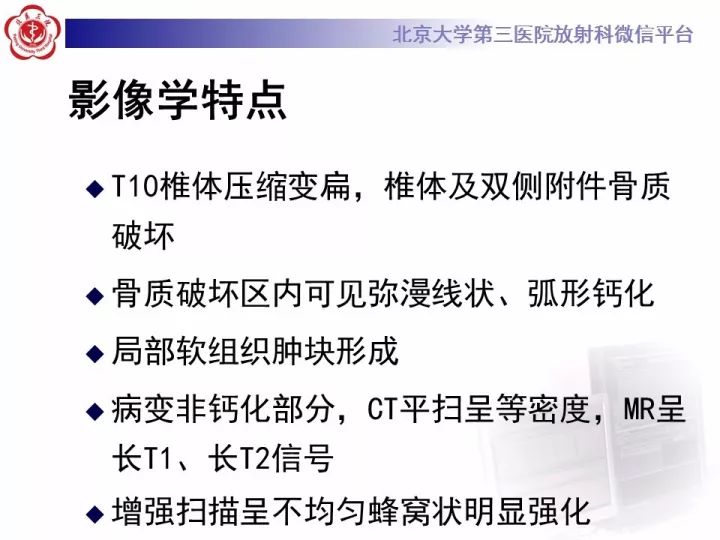 【病例】胸椎软骨肉瘤1例CT及MR影像表现