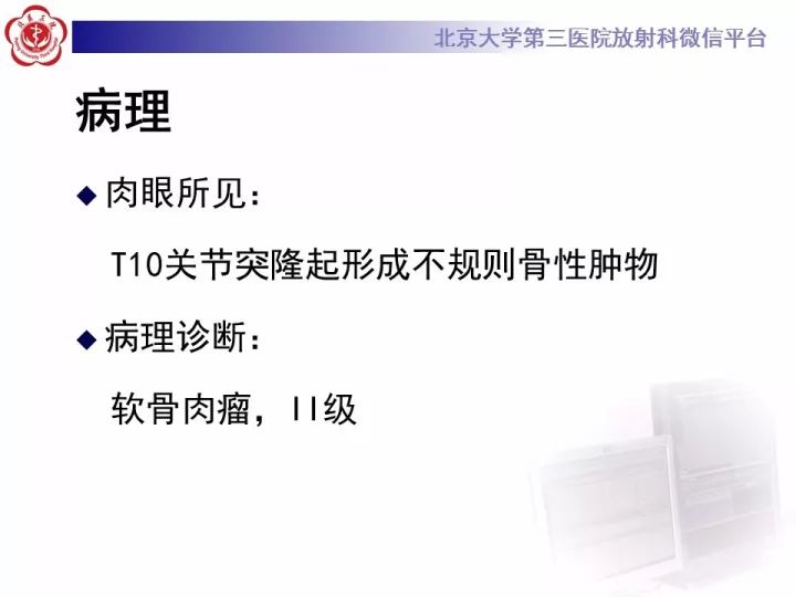【病例】胸椎软骨肉瘤1例CT及MR影像表现