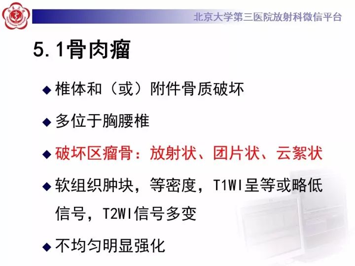 【病例】胸椎软骨肉瘤1例CT及MR影像表现