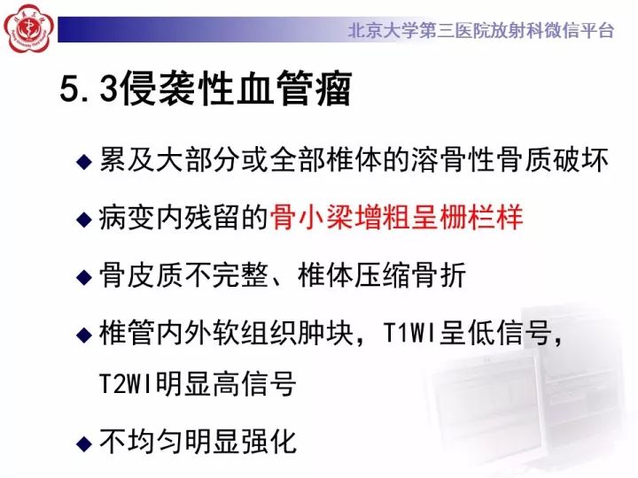 【病例】胸椎软骨肉瘤1例CT及MR影像表现