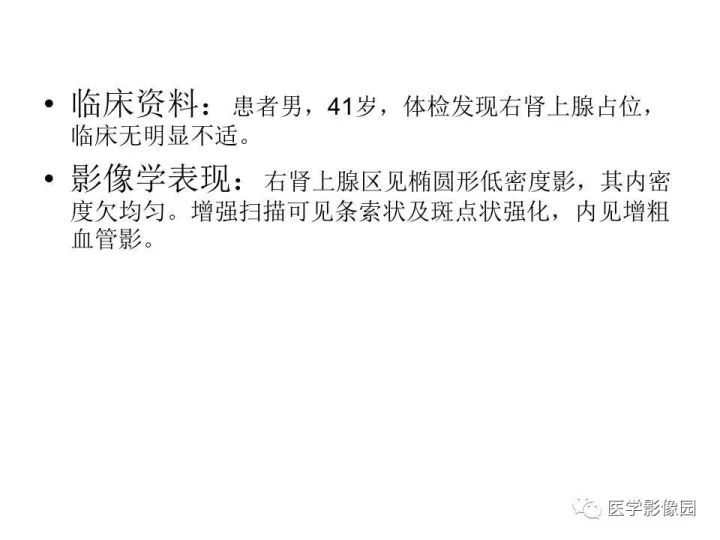 【病例】肾上腺血管平滑肌脂肪瘤1例CT影像表现