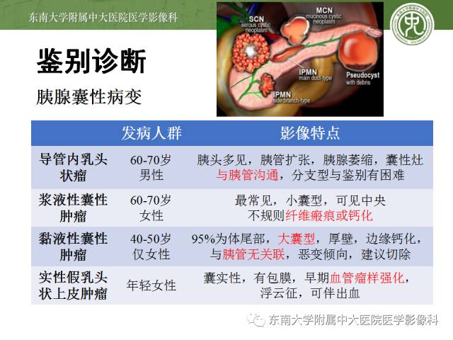 【病例】胰腺导管内乳头状黏液性肿瘤1例CT及MR