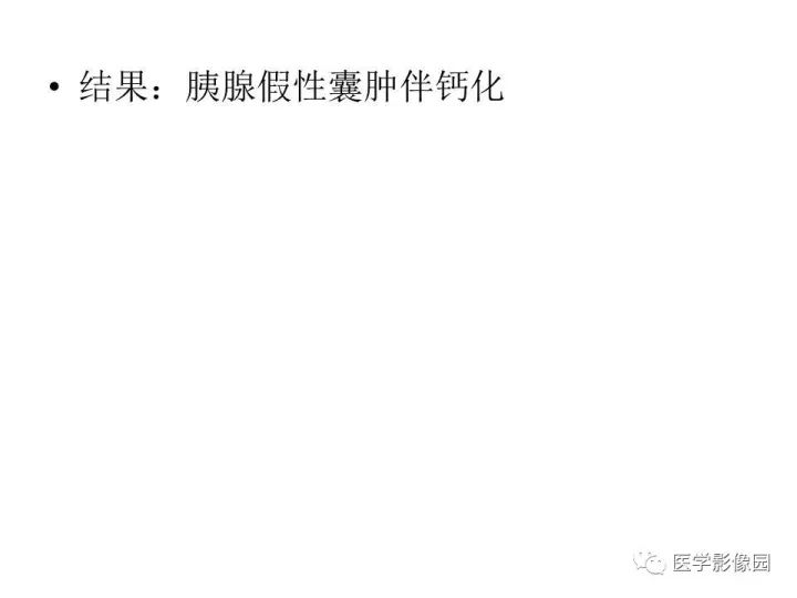 【病例】胰腺假性囊肿伴钙化1例CT影像表现