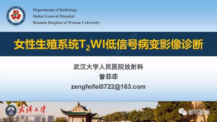 【PPT】女性生殖系统T2WI低信号病变影像诊断
