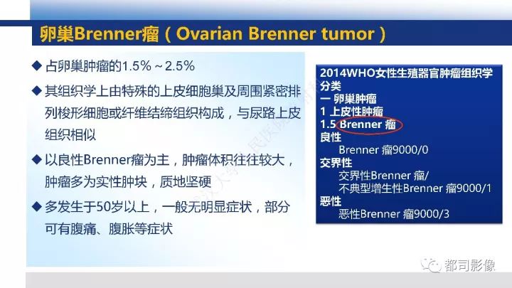 【PPT】女性生殖系统T2WI低信号病变影像诊断