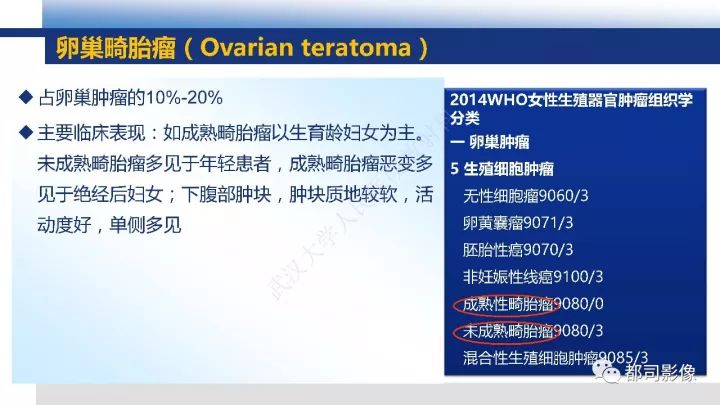 【PPT】女性生殖系统T2WI低信号病变影像诊断
