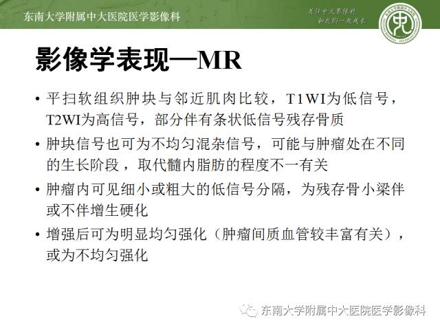 【病例】骶骨孤立性浆细胞瘤1例CT及MR影像表现