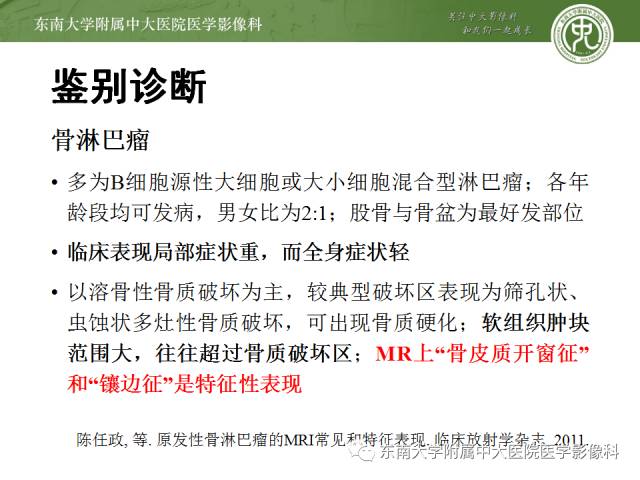 【病例】骶骨孤立性浆细胞瘤1例CT及MR影像表现
